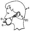 Patent8b.gif