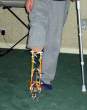 you can make anything with some legos, even a new leg!.jpg