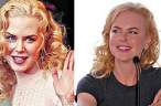zabava_botoks_kidman.jpg