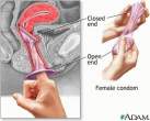 Female condom.jpg
