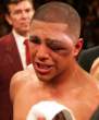 Fernando Vargas' Eye.jpg
