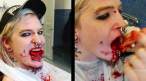Bloody.jpg