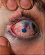 eye3.img_assist_custom.jpg