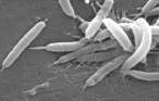 Helicobacter Pylori 6.jpg
