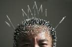 acupunctureneedles.jpg
